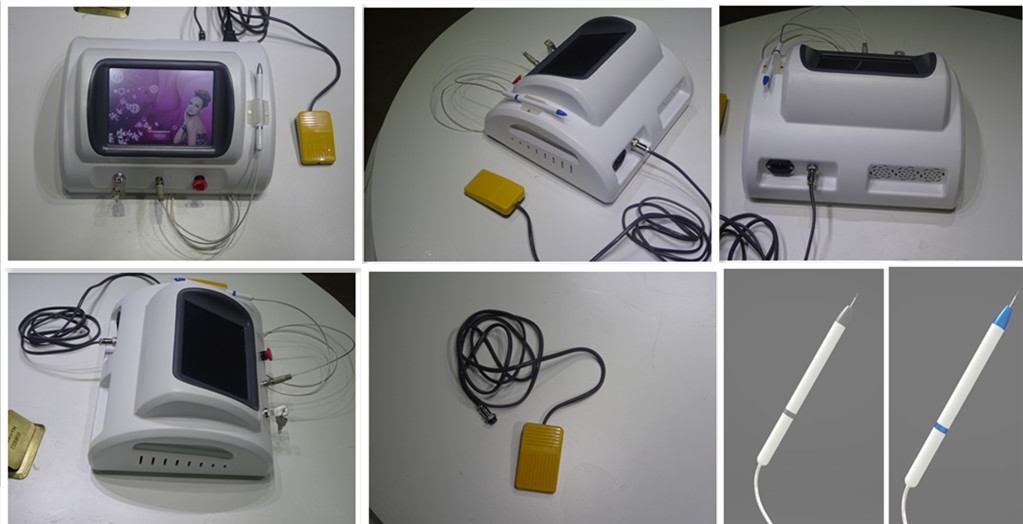 hi-tech effective painfree spider vein removal machine high frequency facial machine portable